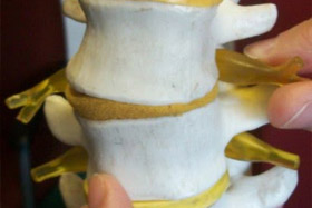 chiropractic adjustments